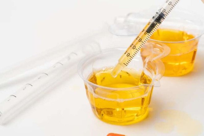 早晨第一泡尿,可能是身体在呼救!这些信号别忽略_无忧资讯-EnglishX