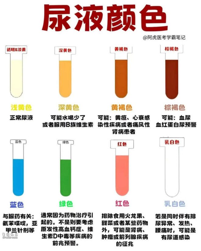 图片[3]-早晨第一泡尿,可能是身体在呼救!这些信号别忽略_无忧资讯-EnglishX